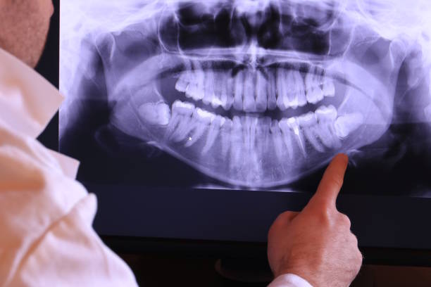 Best Emergency Root Canal Treatment in Oostburg, WI