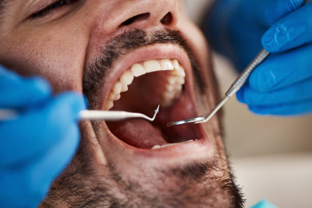 Best Urgent Care for Lost Fillings or Crowns in Oostburg, WI